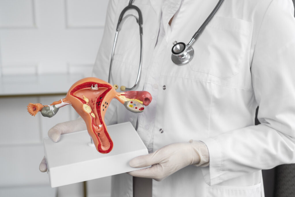 trattamenti fibromi uterini potenza
